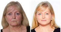 Thumbnail for ANTI-AGING SKIN SOLUTION