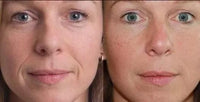 Thumbnail for ANTI-AGING SKIN SOLUTION