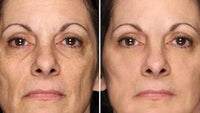 Thumbnail for ANTI-AGING SKIN SOLUTION